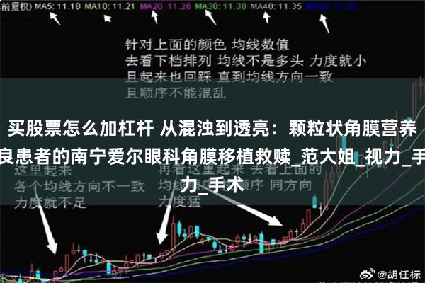 买股票怎么加杠杆 从混浊到透亮：颗粒状角膜营养不良患者的南宁爱尔眼科角膜移植救赎_范大姐_视力_手术